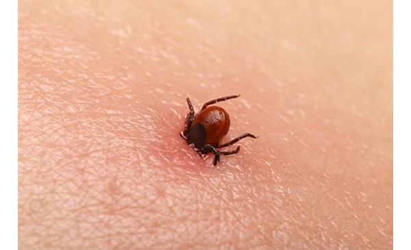 Maladie de Lyme : protégez-vous des tiques!